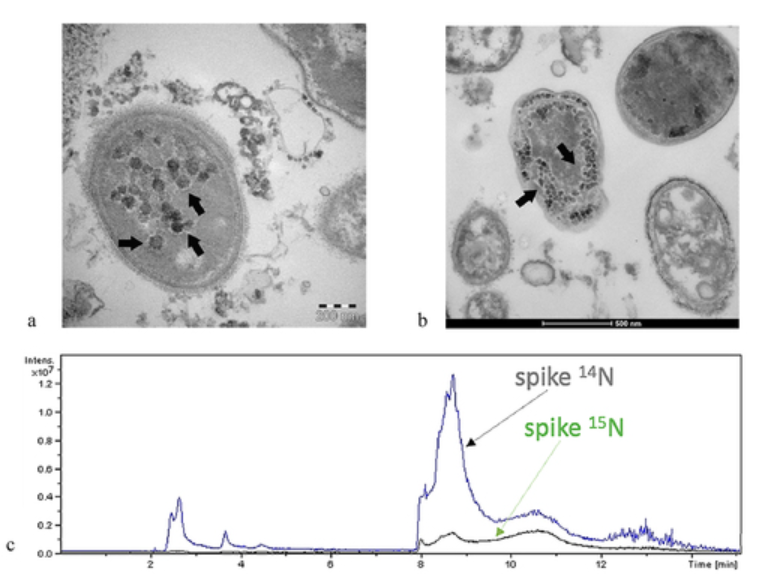 The importance of gut microbiome in the pathogenesis and transmission of SARS-CoV-2